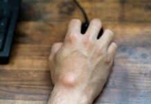 13 Remedies For Ganglion Cyst For Faster Recovery 13-Remedies-for-Ganglion-Cyst-for-Faster-Recovery