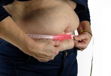 12 Health Risks Associated With Obesity – Know The Risks! Health risks associated with obesity
