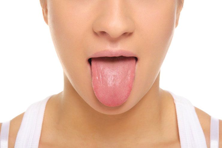 How to diagnose tongue problems
