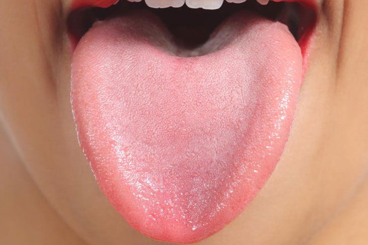 Signs and symptoms of tongue problems