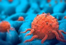 New Study Finds Mechanisms By Which Pancreatic Cancer Cells Avoid Starvation pancreatic-cancer-cells