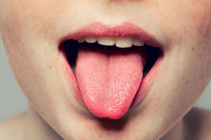 treatment of tongue problems