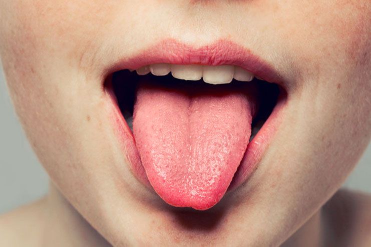 Treatment Of Tongue Problems – 14 Effective Ways That Work