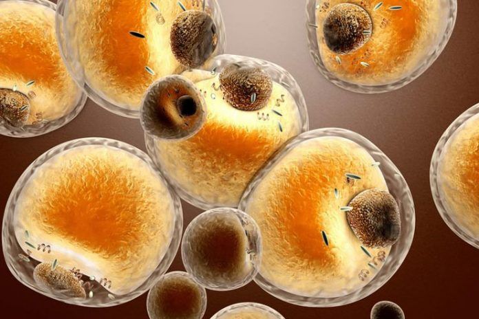 what happens to fat cells after weight loss