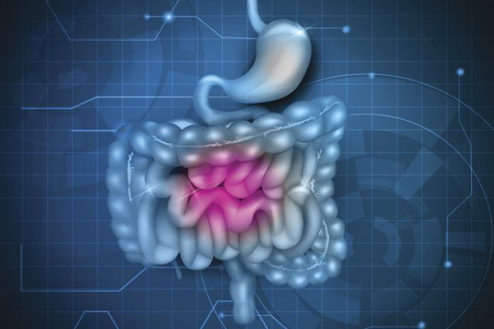 9 Ways To Heal Leaky Gut Fix Part Of Your Digestive System