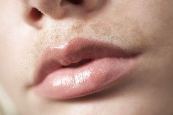 How To Lighten Dark Upper Lip 10 Home Remedies For Better Results