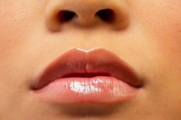 How To Prevent Darkness From Upper Lip