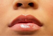 How To Lighten Dark Upper Lip? 8 Home Remedies For Better Results Lighten Dark Upper Lip