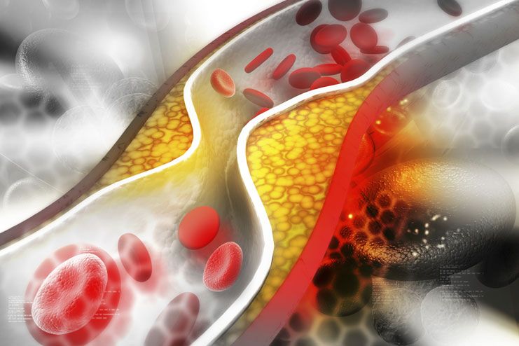 Lower cholesterol levels