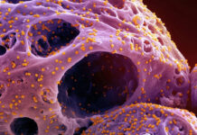 10 Things You Must Know About Zombie Virus – Top Cases in World Zombie-Virus-1