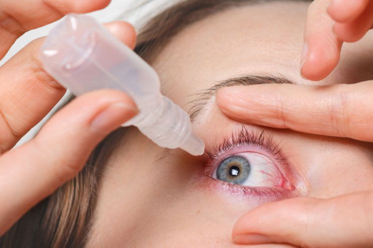 Dry Eyes Symptoms Causes