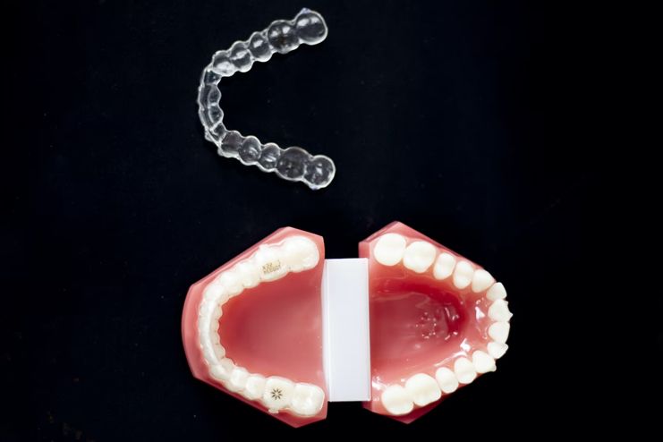 How-to-Choose-a-Mouthguard-for-Teeth-Grinding