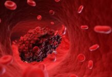 Natural Remedies for Blood Clot Prevention: What Works and What Doesn’t Blood Clot Prevention