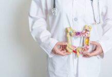 Diverticulitis and Exercise: Staying Active Without Aggravation Diverticulitis and Exercise