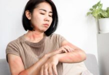 Hives or Rash? How to Tell the Difference and When to See a Doctor Hives or Rash How to Tell the Difference