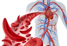 Transform Your Health: 5 Lifestyle Changes to Prevent Blood Clots Lifestyle Changes to Prevent Blood Clots