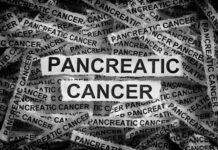 Early Symptoms of Pancreatic Cancer: What to Look For Early-Symptoms-of-Pancreatic-Cancer