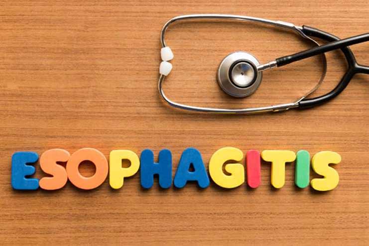 Esophagitis-and-Ulcers