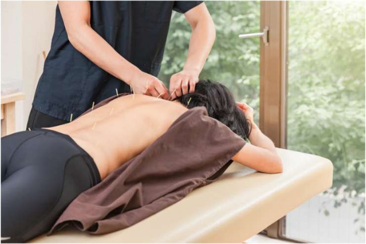 Acupuncture and Massage