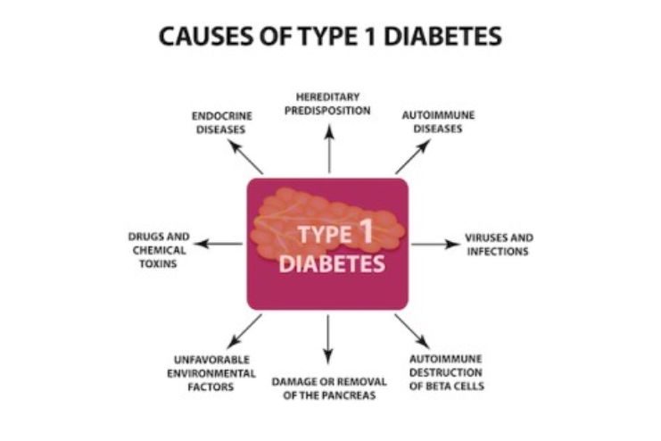 Causes and Risk Factors