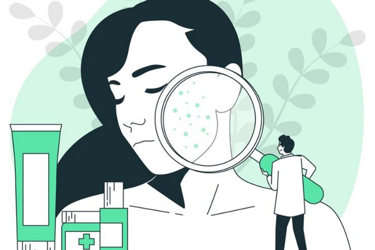 Diagnosing the Right Type of Acne