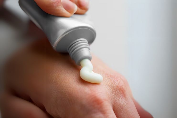 Fungal Acne Treatments