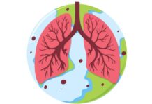 Managing Idiopathic Pulmonary Fibrosis (IPF) Managing Idiopathic Pulmonary Fibrosis IPF