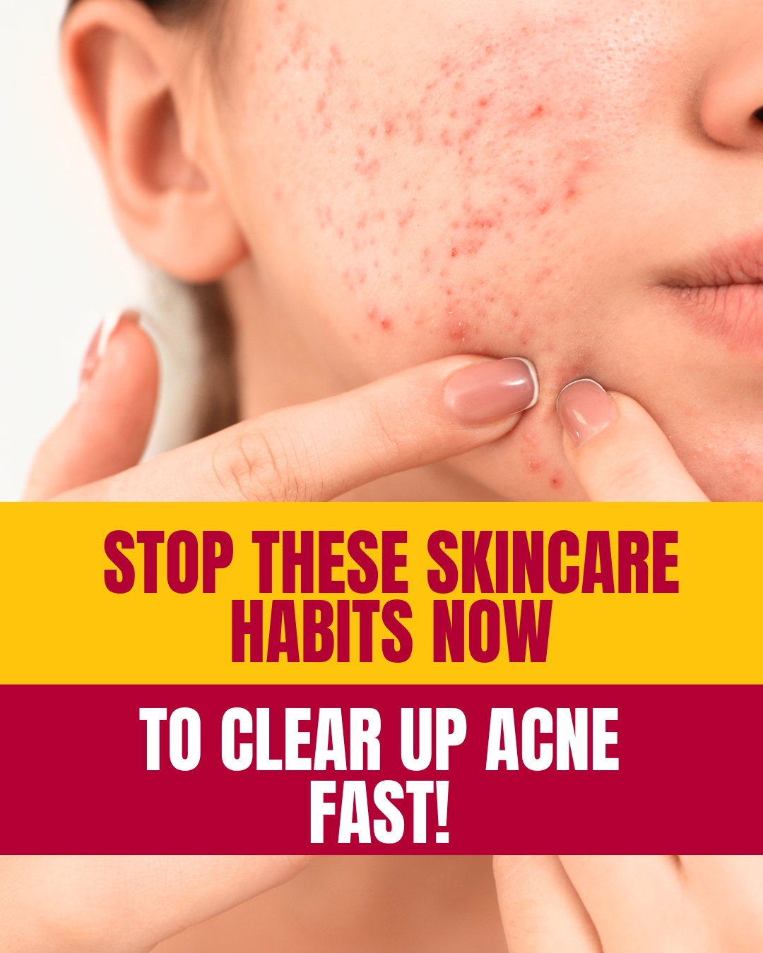 Stop These Skincare Habits Now To Clear Up Acne Fast
