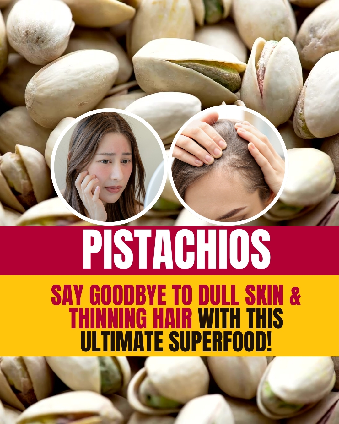 Pistachios: Say Goodbye To Dull Skin & Thinning Hair With This Ultimate Superfood!