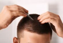 5 Products That Stimulate Hair Growth in Men 5 Products That Stimulate Hair Growth in Men