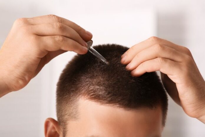 5 Products That Stimulate Hair Growth in Men