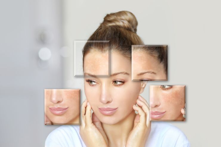 Repair a Damaged Skin Barrier