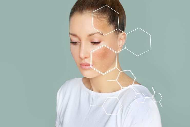 Skin Barrier