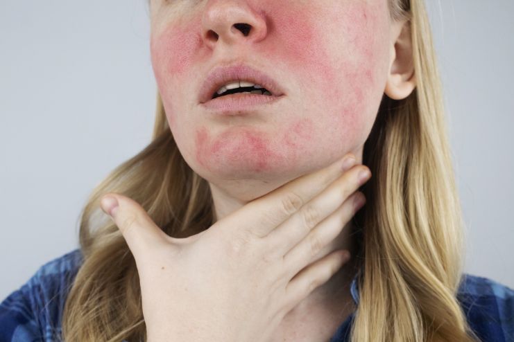 Skin with Actives