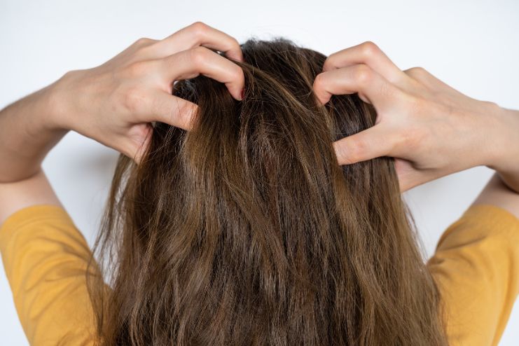 Itchy Flaky Scalp