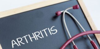 5-Minute Daily Mobility Routine for Arthritis You Can Do at Home Daily Mobility Routine for Arthritis