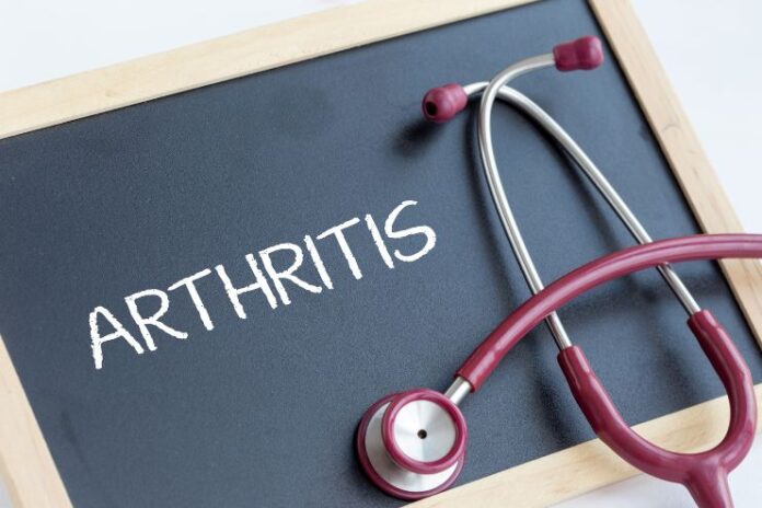 Daily Mobility Routine for Arthritis