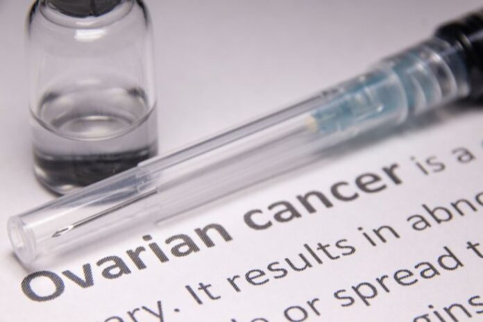 Ovarian Cancer Stages Explained