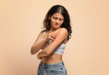 Top 8 Psoriasis Creams: Soothing Skincare Solutions for Flare-Ups Psoriasis Creams