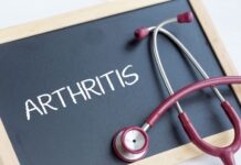 Early Signs of Arthritis in Your 30s You Shouldn’t Ignore Arthritis Early Signs