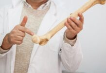 Bone Density Loss After 30: Early Signs, Causes, and How to Reverse It Naturally Bone Density Loss After 30