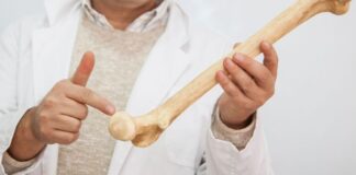 Bone Density Loss After 30: Early Signs, Causes, and How to Reverse It Naturally Bone Density Loss After 30