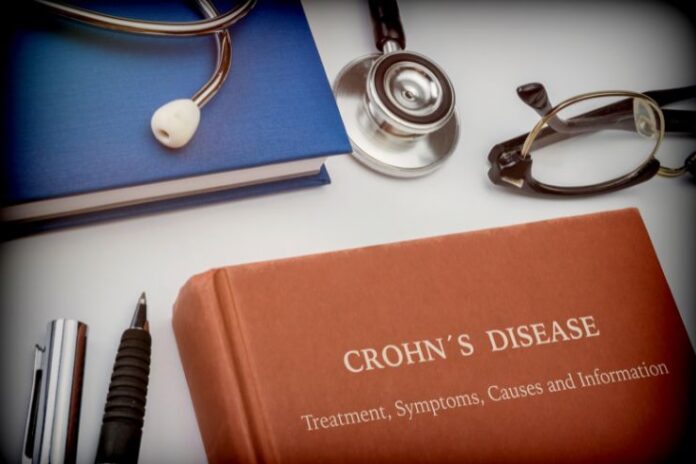 Crohns Disease Complications