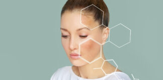 Allergic to Touch? Understanding Dermatographia (Skin Writing Hives) Allergic to Touch Dermatographia