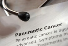 8 Pancreatic Cancer Symptoms You Shouldn’t Ignore Pancreatic Cancer Symptoms