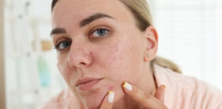 If Popping Pimples Is So Bad, Why Do Estheticians Still Do It? A Dermatologist Explains Popping Pimples Is So Bad