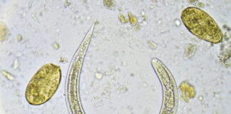 This Parasitic Worm Can Turn Off Pain—What Scientists Are Learning About Its Surprising Power This Parasitic Worm Can Turn Off Pain