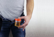 Why Is My Urine Brown? Causes, Symptoms, and When to See a Doctor Why Is My Urine Brown Causes Symptoms and When to See a Doctor