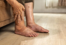 Best Stretches for Tired or Swollen Feet After Work Best Stretches for Tired or Swollen Feet After Work