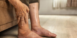 Best Stretches for Tired or Swollen Feet After Work Best Stretches for Tired or Swollen Feet After Work
